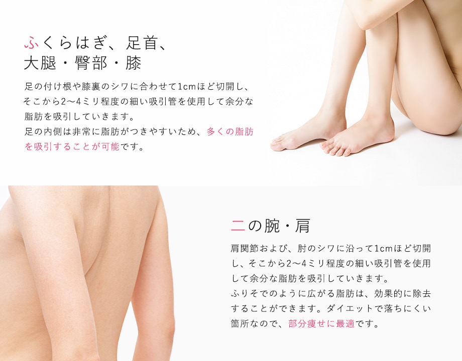 ふくらはぎ、足首、大腿・臀部・膝、二の腕・肩