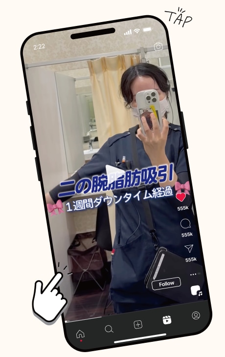 二の腕脂肪吸引のダウンタイム