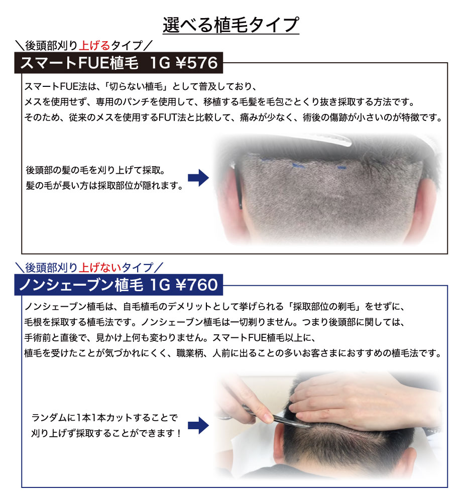 M字植毛】丁寧なカウンセリングと長年培ったデザイン力でご希望の姿へ