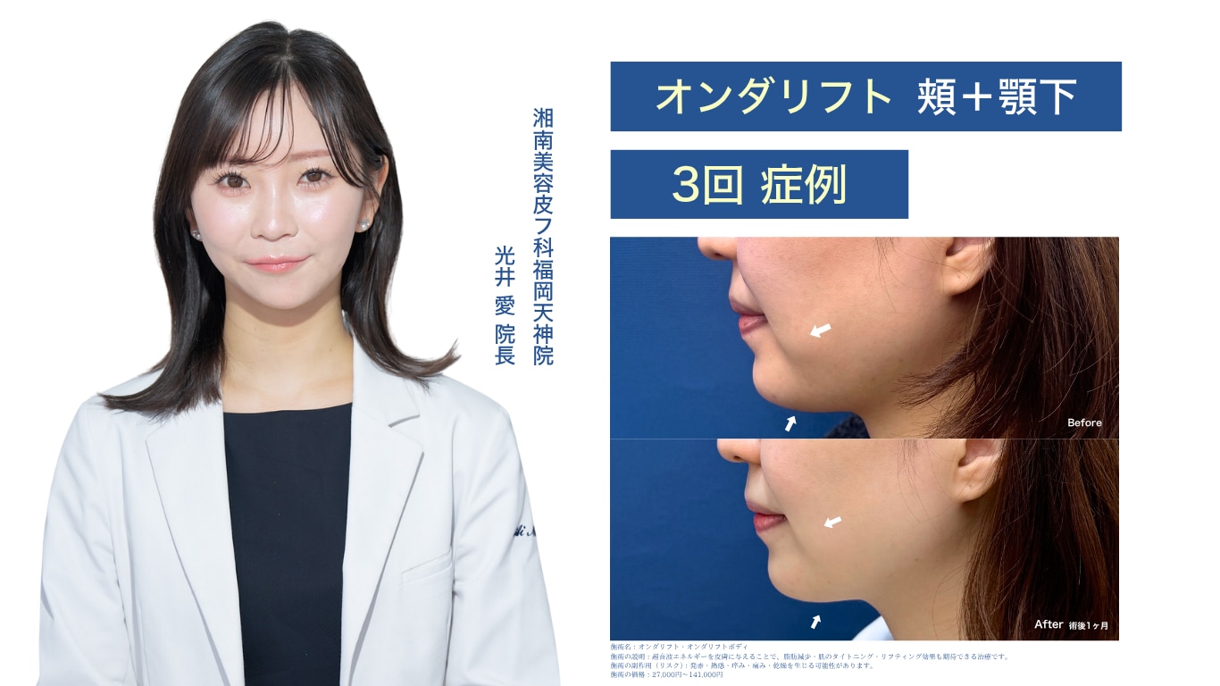 オンダ症例写真