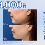 オンダサムネ画像