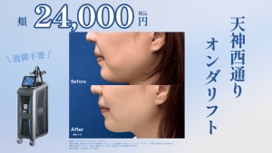オンダサムネ画像