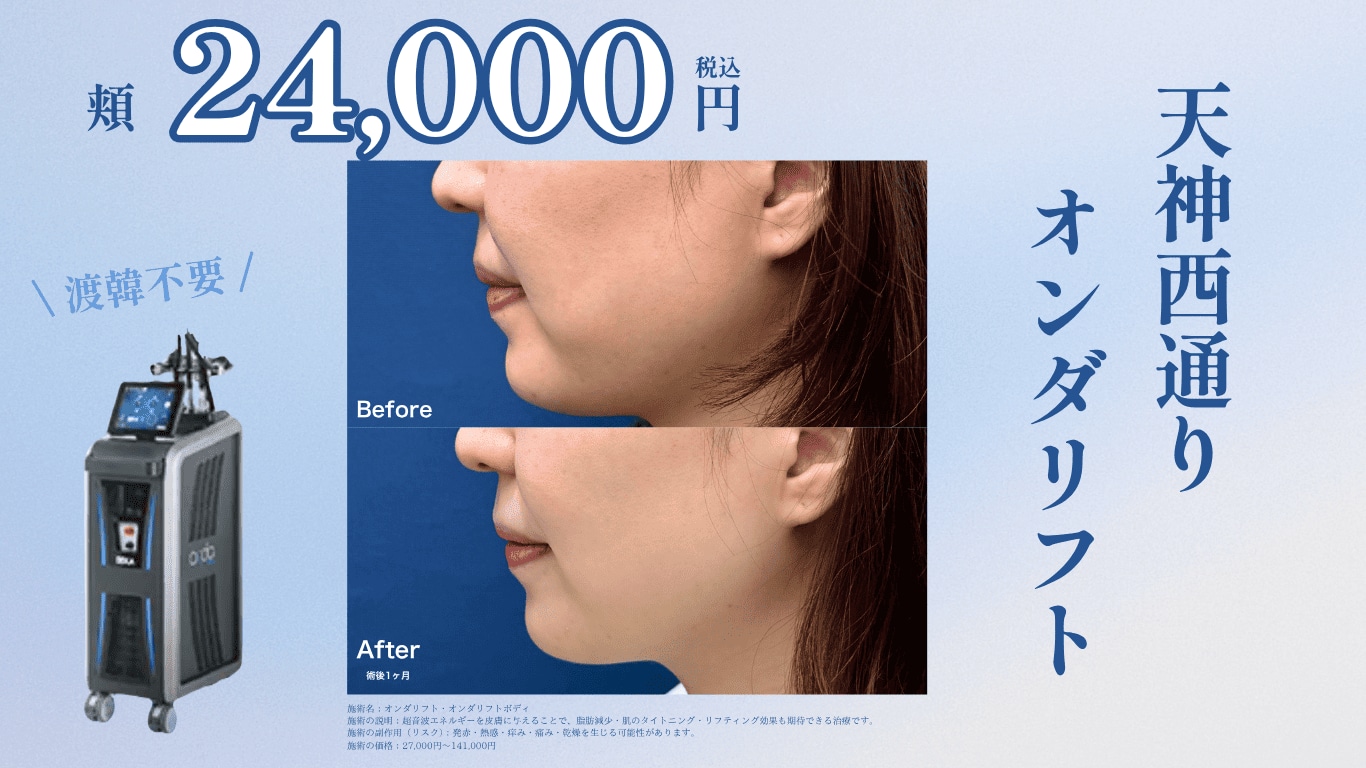 オンダサムネ画像