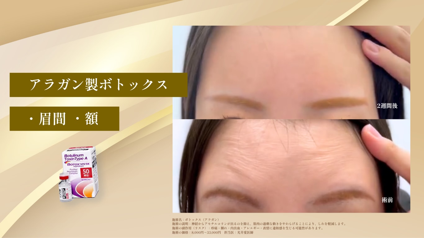 額ボト症例写真