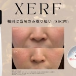 サテライトXERFサムネ