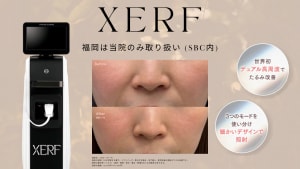 サテライトXERFサムネ