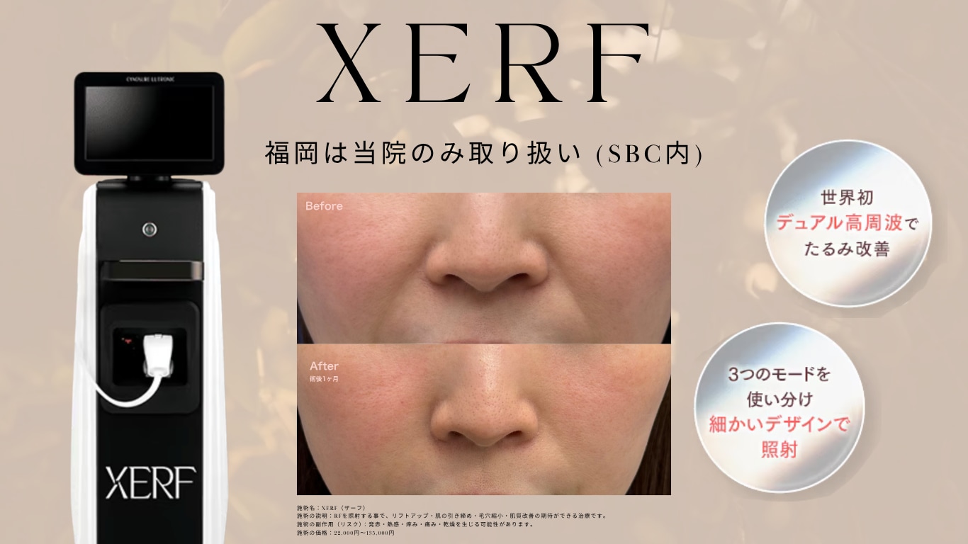 サテライトXERFサムネ