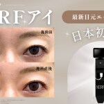 xerfeyeサムネ画像