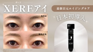 xerfeyeサムネ画像