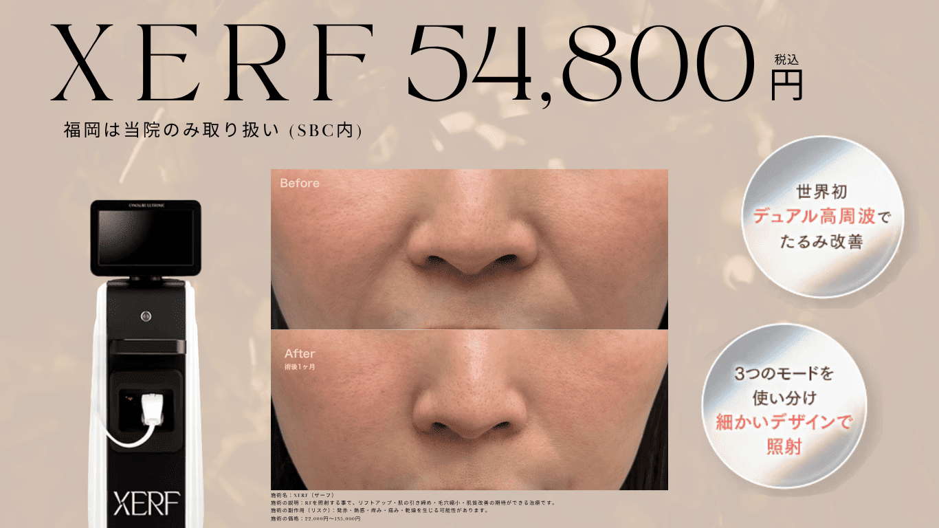 サーマル　高周波　リフトアップ XERFが54,800円(税込)】天神西通り｜たるみ改善｜西鉄福岡駅5分の湘南