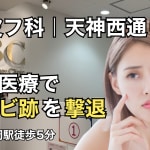 ニキビサムネ
