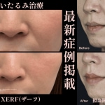 サテライトXERFサムネ