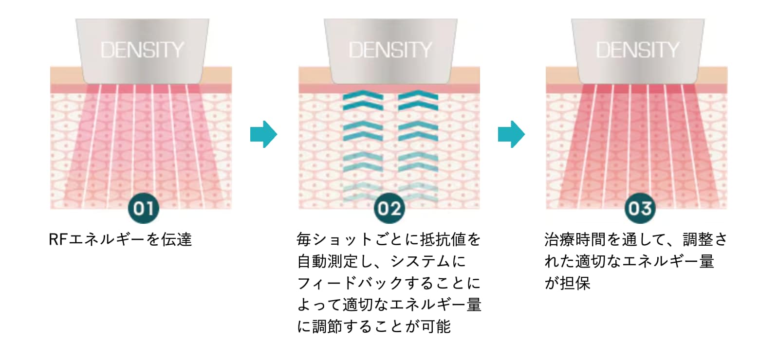 デンシティ画像