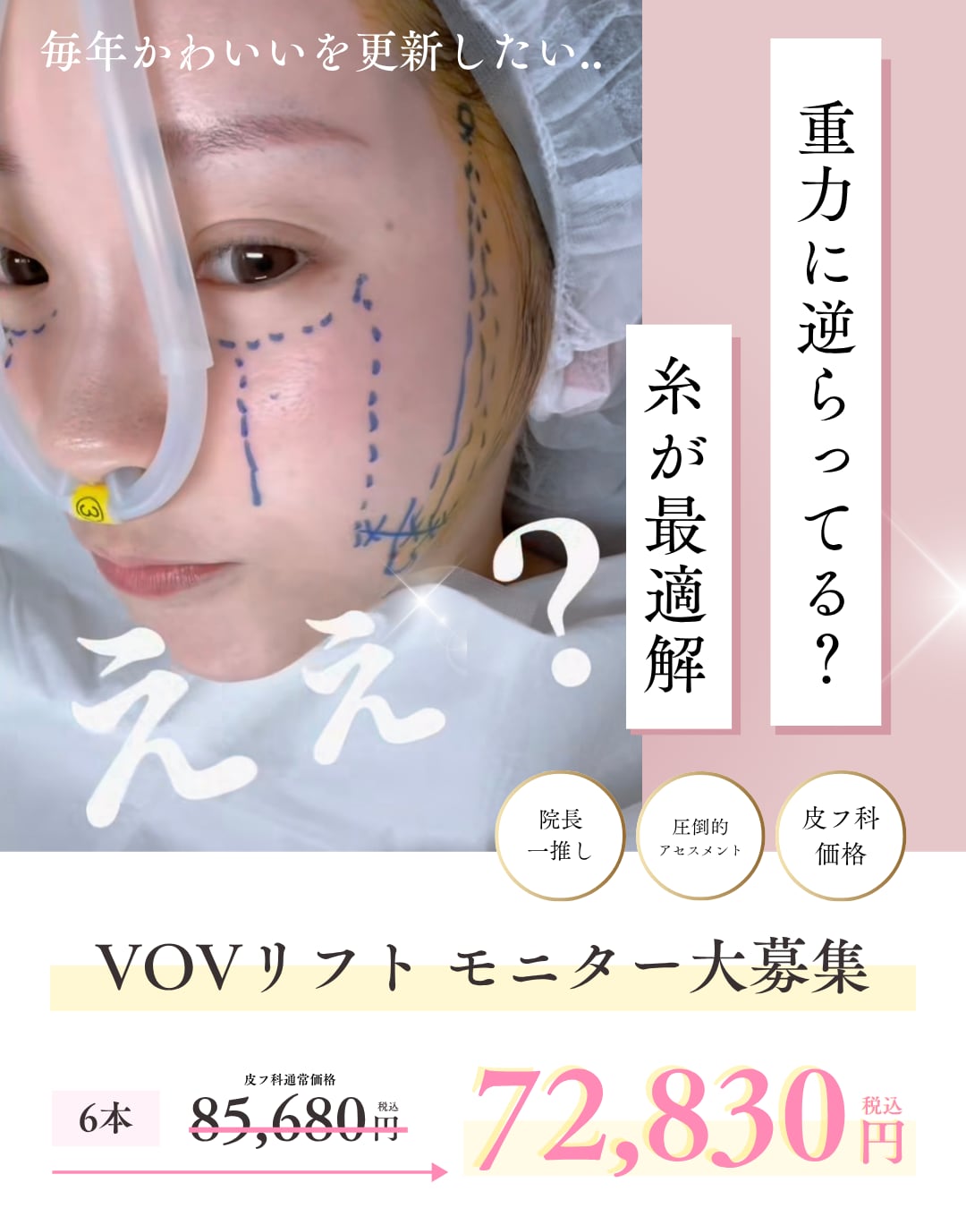 糸モニター募集