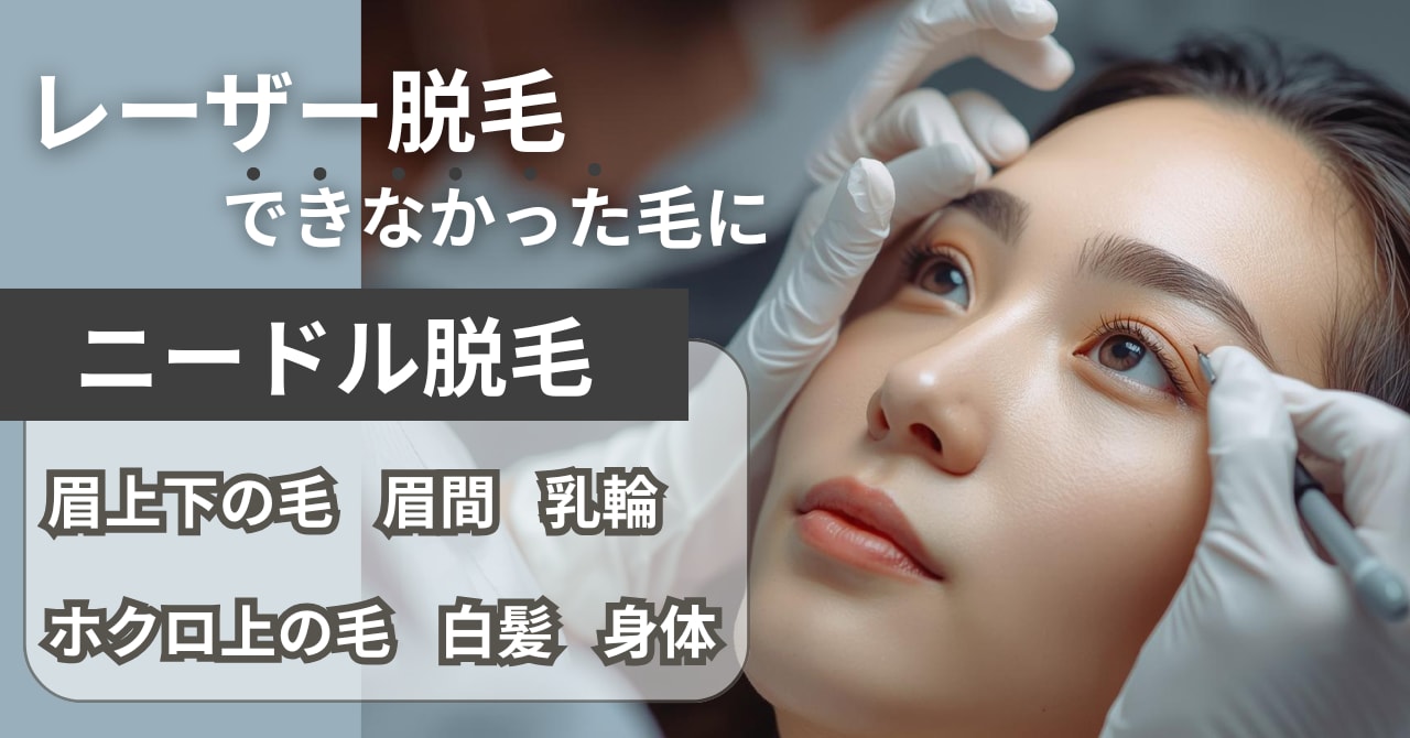 ニードル脱毛のイメージ写真で解説あり