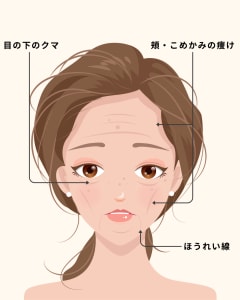 デューコラーゲン施術可能箇所