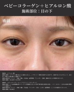 症例写真