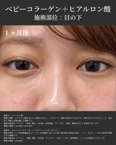 症例写真