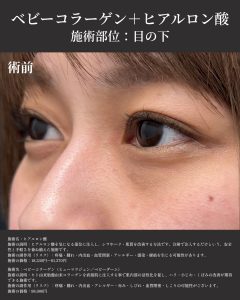 症例写真