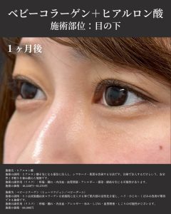 症例写真