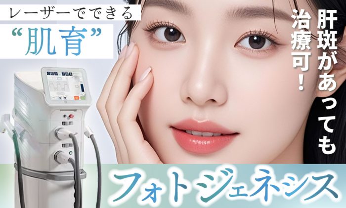 レーザー肌育治療フォトジェネシスをするなら皮フ科梅田茶屋町院へ