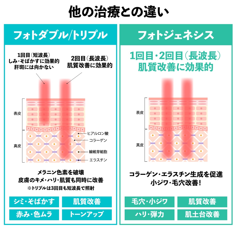 フォトジェネシスとフォトダブル・フォトトリプルとの違い