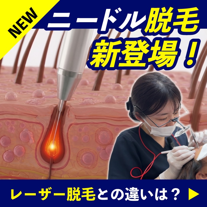 梅田でニードル脱毛20本まで10,000円｜阪急大阪梅田駅徒歩2分｜皮フ科