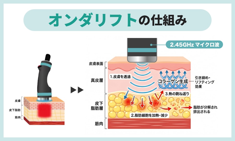オンダリフトの仕組み図