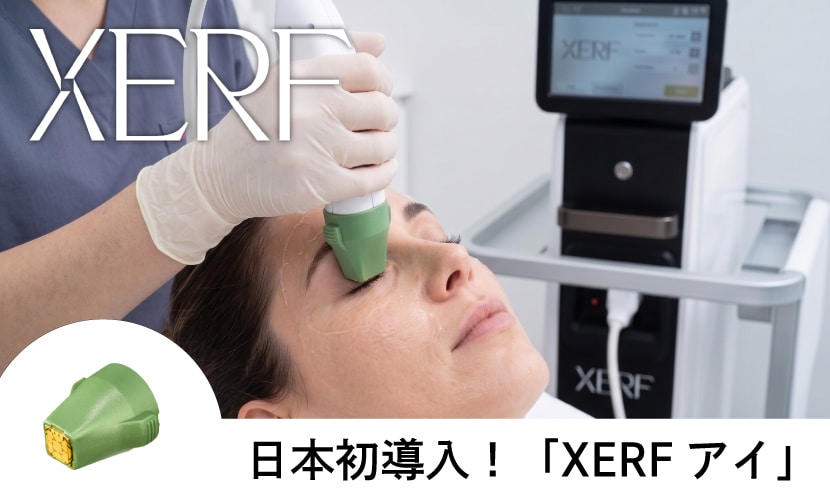 XERFアイ