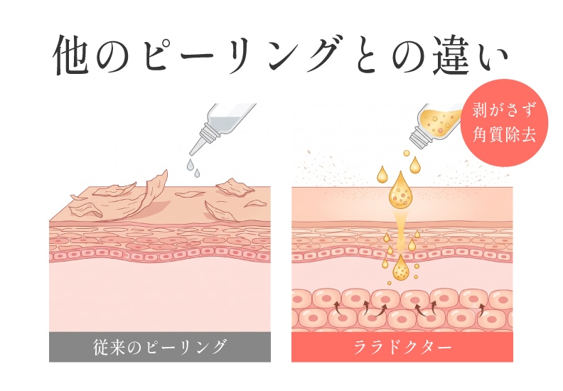 ララドクター他のピーリングとの違い