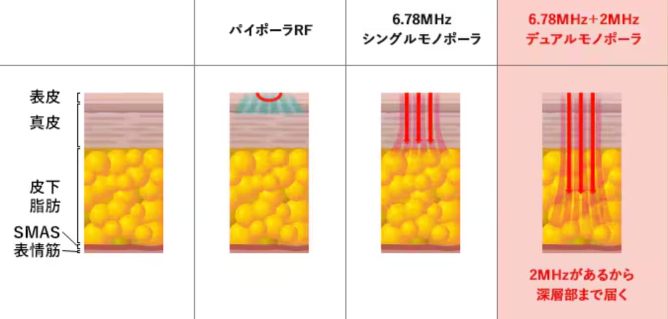 周波数イメージ