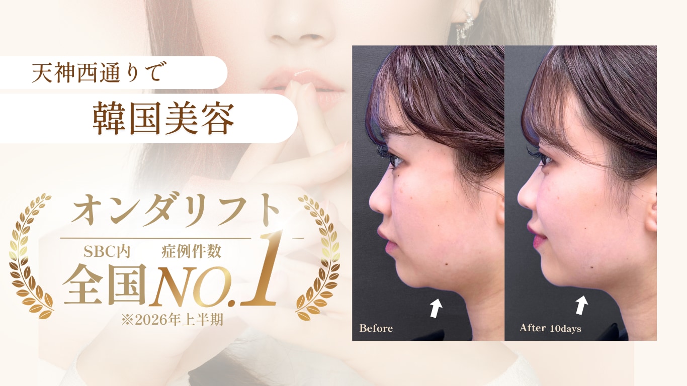 オンダサムネ画像
