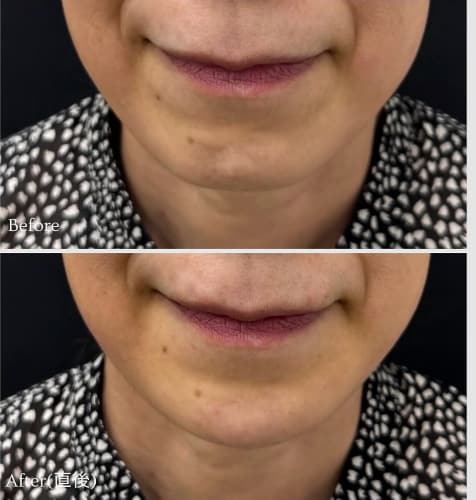 症例写真