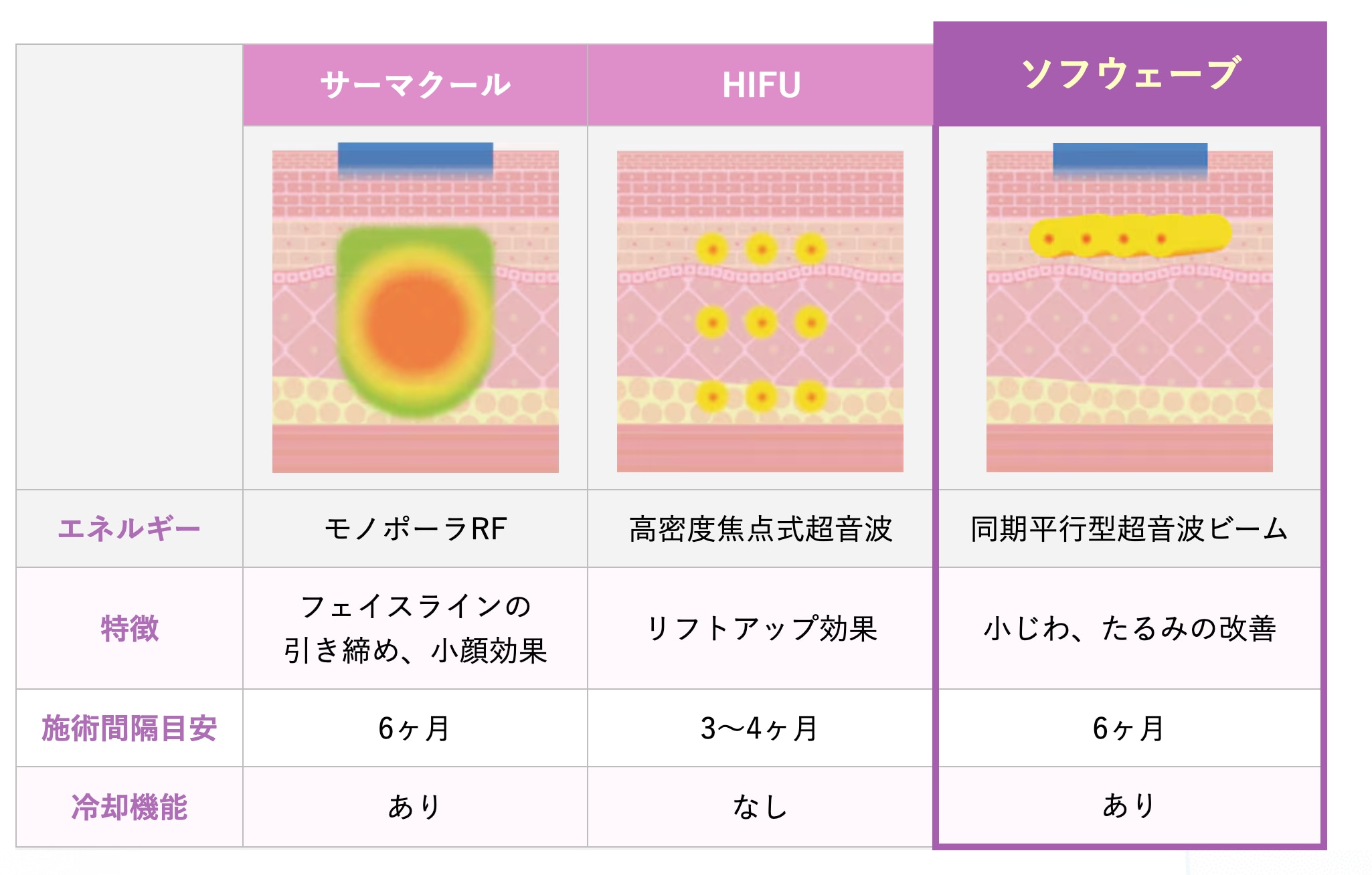ハイフとの違い画像