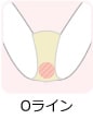 Oライン