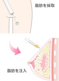 バッグ