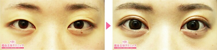 二重整形・目元なら湘南美容クリニック|美容整形・美容外科