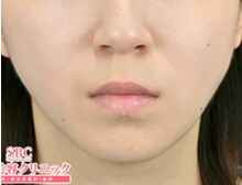 今月のベスト症例写真