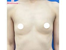 今月のベスト症例写真