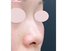 今月のベスト症例写真