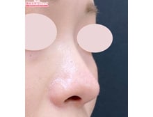 今月のベスト症例写真