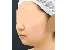 今月のベスト症例写真