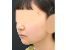 今月のベスト症例写真