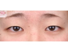 今月のベスト症例写真