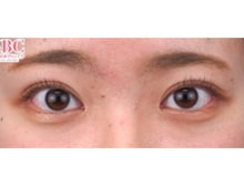 今月のベスト症例写真