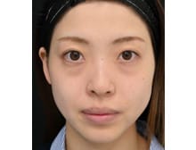 今月のベスト症例写真