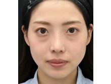 今月のベスト症例写真