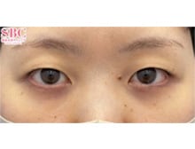 今月のベスト症例写真