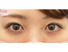 今月のベスト症例写真