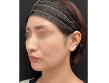 今月のベスト症例写真